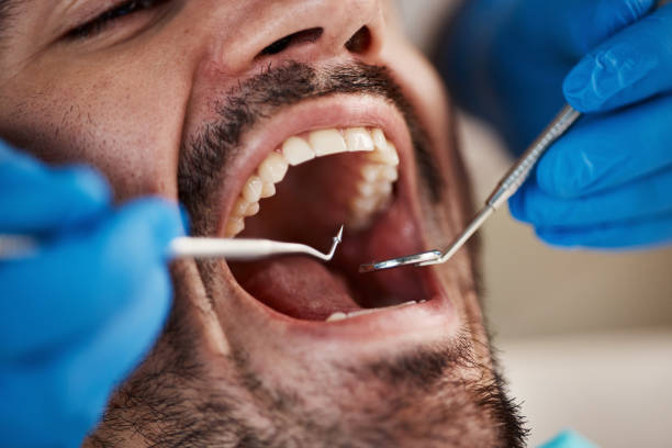 Best Chipped Tooth Repair Near Me  in Casey, IL