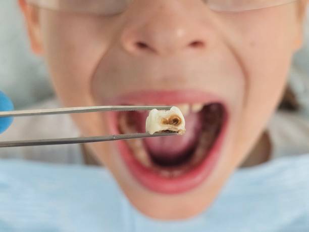 Best Broken Tooth Emergency  in Casey, IL